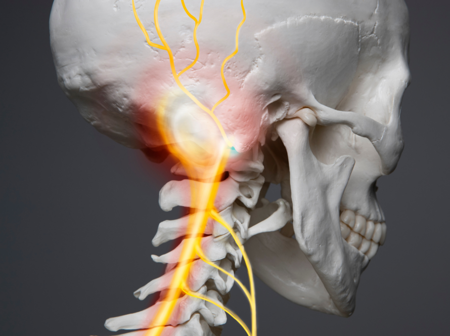 Occipital Nerve